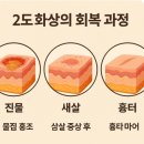 [청심연자음][침치료][화상치료][영은한의원][자운고][약침치료]