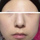 화수돈 | 유이크 바이옴 비타C 2스텝 하이드로 겔 마스크 내돈내산 사용후기