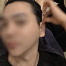 구로 두피관리 모바이오 가산점 두피 전후 비교 솔직 후기