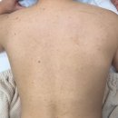 다은 | 서울대입구 등드름관리 알라딘필링, 봉천 에스테틱 다은 솔직후기