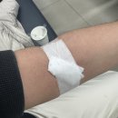 옥룡동 주민센터 | 미세변화신증후군(13) 충남대학교병원 신장내과 류마티스내과