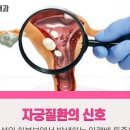 여자 오른쪽 왼쪽 아랫배 통증 누르면 찌릿 콕콕 이미지