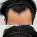 뷰티헤어라인 이미지