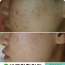 바른침한의원 이미지