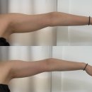 평택합정SKVIEW 주상복합 | 💖[웨딩케어 재방문 솔직 후기] 믿고 다시 간 평택 밀도뷰티랩 극초단파 마이크로웨이브(온다리프팅...