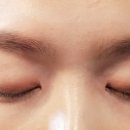 뷰티라썸