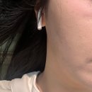 나주사 | 예신 피부 관리 추천 - 리쥬란 + 물광주사 리뷰 후기