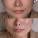 로지에스떼