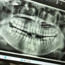 자기치아살리기드림플란트치과의원 이미지