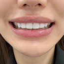 굿디자인 치과기공소 네이버블로그