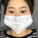 수정헤어라인 티스토리