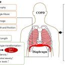 Re: COPD 환자.. 횡격막 근육의 기능부전 치료적 운동 전략 2022 리뷰!! 이미지