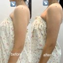 목중`대성로 | 청주 에스테틱 [후광미인] 등관리 후기 / 어깨케어 승모근케어 윤곽관리 잘하는 곳