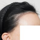 바람부는날에도 성형외과의원 이미지