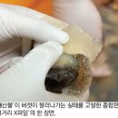 소라광고 이미지