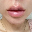 차빛의원 이미지