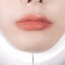 브이케어 이미지