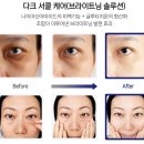 케어셀라 지쿱 | 지쿱 케어셀라 아이 퍼프 크림, 1분의 기적!!