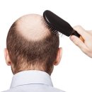 우후죽순식품(유) | 선선한 가을바람과 함께 찾아온 탈모…가을엔 왜 머리카락 잘 빠지나?
