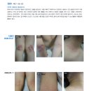 한빛약품㈜ | [아토피 관리가이드] 아토피를 정복하자!