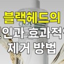 메디수