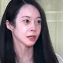 윤지패션 | 김윤지 피부 시술 2달 후 비포 애프터 공개 리프팅 고민 해결