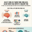 더 콕스(The cocs) | [연구 논문] 조기 치매 예방: 당뇨와 우울증이 조기 치매 위험을 2배 이상 높인다?