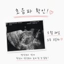 고옥산부인과의원 네이버블로그