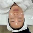 이피온드스킨