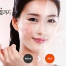 강남레쥬베의원 이미지