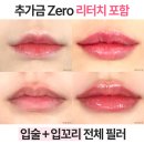부평입술필러잘하는곳 와이랩 성형외과의원 입술필러후기