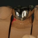 민치아치과기공소 이미지