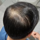 &#34;비오틴 샴푸 추천템 온가족 순한 저자극 탈모샴푸 1위&#34;