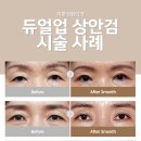 미본 이미지