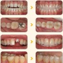 옥스치과기공소 이미지