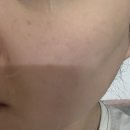 스킨케어5000 | 다이소 마미케어 바다포도 스킨팩 내돈내산 솔직후기