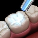 동그라미 치과기공소 이미지