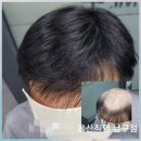 울산가발 좋은가발 울산남구점에서 중년가발 착용후기..