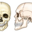 두개골 골절(Skull Fracture) 근 골격질환이란? 이미지