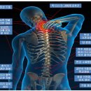 척추/골반/재활[척추 수술/시술 판정 및 재발하신 분 전문.. 목 & 허리 디스크, 척추 협착증 & 측만증 & 분리증, 좌골신경통..] & 보디빌딩 1:1 맞춤 운동 전문 이미지