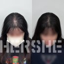 브로우리즈