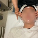 다뽑자 | [동탄] 동탄문제성 피부 뽑자슈가링 스킨리포어 여드름압출 관리 후기
