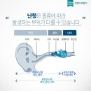 독일 보청기 양산센터 이미지
