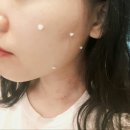 제이드비뇨기과의원 | 양산증산 댄피부과에서 점빼고 왔어요~솔직후기