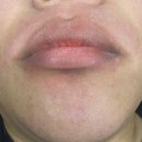 벨르뮤 | 청주 남자왁싱, 벨르뮤 턱라인 깔끔 후기