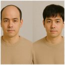경기도 수원시 권선구 경수대로225번길 72 | 수원항암가발 자신감을 되찾게 해준 미소모의 맞춤 가발 후기