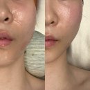 리지에스테틱 | 분당 정자동 피부관리 리지에스테틱에서 얼굴 작아진 후기