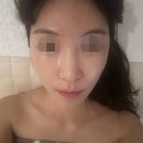 힐링탑 피부관리실