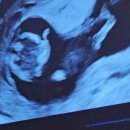 서초하나산부인과의원 이미지