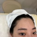 퀸헤어라인 이미지